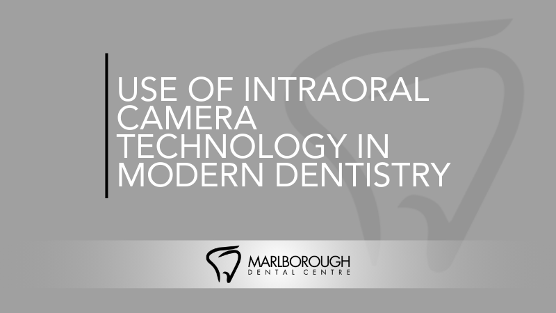 How Intraoral Camera Technology Improves Accuracy in Modern Dentistry
